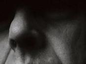 Chronique loups blessés