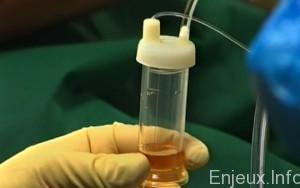 Le secteur de la biotechnologie menacé par une bulle spéculative