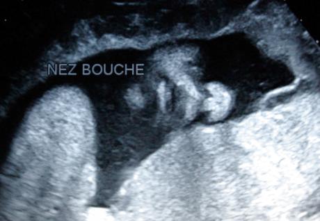 Dans le flou du diagnostic