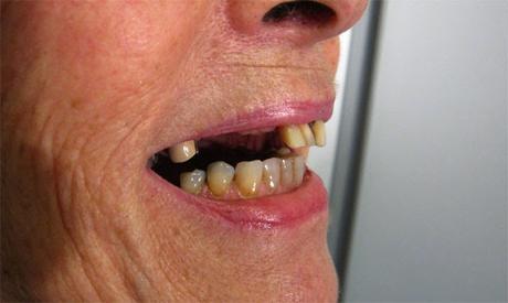 Marisol Touraine: Les sans dents ne vous disent pas merci !