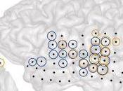 Découverte scientifique majeure: l’acouphène bien cérébral! Philippe Barraqué