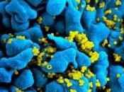 VIH: ouvre-boîte moléculaire pour décapsuler virus PNAS
