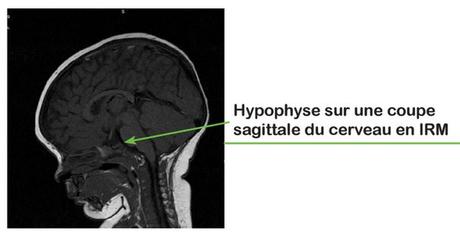 PÉDIATRIE : Congrès à Tours du 26 au 29 mai et zoom sur l’endocrinologie – CHRU Tours