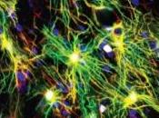 SUICIDE DÉPRESSION: astrocytes accusation Molecular Psychiatry
