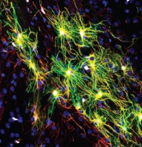 SUICIDE et DÉPRESSION: Les astrocytes mis en accusation – Molecular Psychiatry