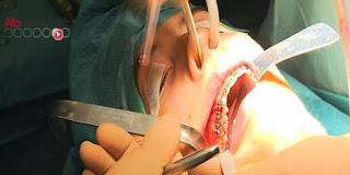 #thelancet #chirurgielourde #hôpital #réadmissionàl'hôpital Destination de réadmission et risque de mortalité après chirurgie lourde : étude observationnelle de cohorte