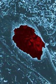 IST: Les promesses d'un candidat vaccin anti-chlamydia  – Science