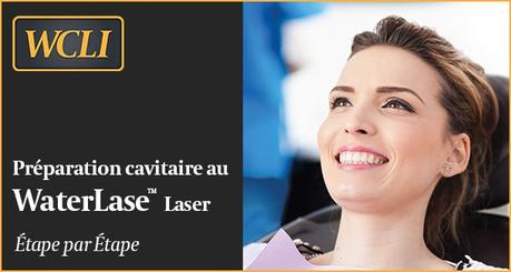 Préparation cavitaire au laser étape par étape