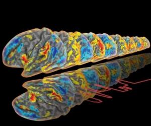 ALZHEIMER: 13 réseaux cérébraux pour une détection précoce – Nature Communications