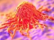 CANCER l'ESTOMAC: Eliminer Helicobacter pylori pourrait réduire risque Cochrane Library