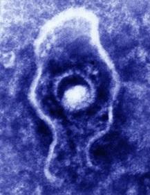 HERPÈS: Avancée vers un test et un vaccin universels – Journal of Virology