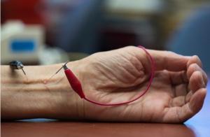 HYPERTENSION (HTA): Et si l'on essayait l'acupuncture ? – Medical Acupuncture