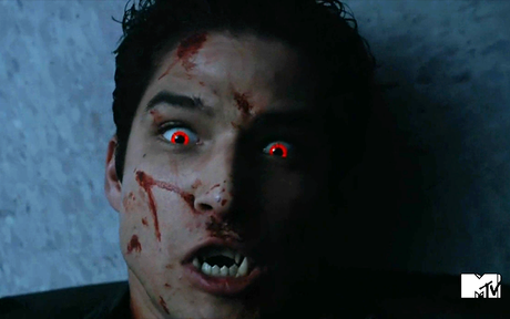 Les critiques // Teen Wolf : Saison 5. Episode 10. Status Asthmaticus. Les critiques // Teen Wolf : Saison 5. Episode 10. Status Asthmaticus.