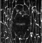 SOIN des PLAIES: L'embryon, un exemple à suivre pour la cicatrisation – Journal of Cell Biology