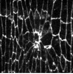 SOIN des PLAIES: L'embryon, un exemple à suivre pour la cicatrisation – Journal of Cell Biology