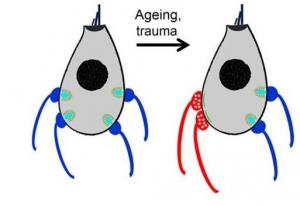 PERTE d'AUDITION avec l'âge: Problème d'oreille interne ou de neurones? – The Journal of Neuroscience