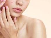 Comment éliminer bouton nuit