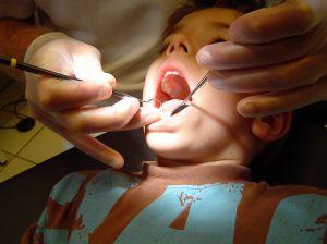 L'érosion des dents chez l'enfant