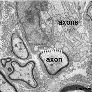 SCLÉROSE en plaques: Découverte d'une protéine clé de la myéline  – Nature Communications