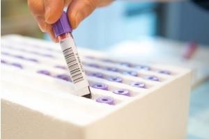 CRISE CARDIAQUE: Le test sanguin qui écarte le risque aux Urgences – The Lancet