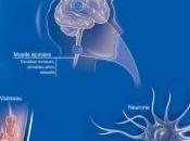 SCLÉROSE plaques: Parvenir cibler mauvais lymphocytes Science Translational Medicine