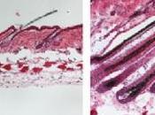 CALVITIE: médicaments déjà approuvés confirment leur effet repousse Science Advances