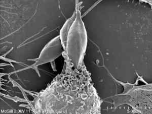 LEISHMANIOSE: Le parasite s'entoure d'un escadron de vésicules  – Cell Reports