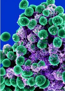 MICI: Curli, la petite protéine du biofilm qui calme l'inflammation  – Biofilms and Microbiomes