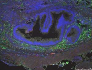 INGÉNIERIE TISSULAIRE: Rétablir la motilité intestinale par cellules souches neurales – Tissue Engineering Part A