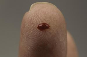 CANCER: Une seule goutte de sang pour identifier l'origine de la tumeur – Cancer Cell