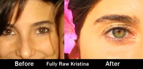 fully-raw-kristina-before-after-iridology-eyes-raw-vegan