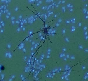 PARKINSON: Ralentir le vieillissement pour protéger les neurones à dopamine – Parkinson's Disease