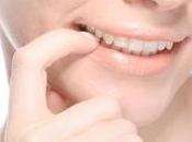 Comment arrêter ronger ongles