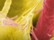 INTOXICATIONS ALIMENTAIRES: fardeau comparable pollution l'air PloS Medicine