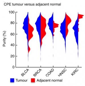 CANCER: La pureté de la tumeur peut fausser la décision de traitement – Nature Communications