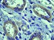 CIRRHOSE: traitement stoppe l'angiogenèse pathologique contrôle maladie Gastroenterology