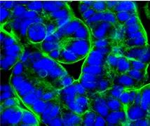 MICROBIOME: Un micro-intestin sur puce révolutionne la recherche  – PNAS
