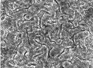 MICROBIOME: Un micro-intestin sur puce révolutionne la recherche  – PNAS