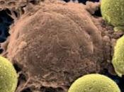 #thelancethaematology #leucémie-GLG-T #alemtuzumab Alemtuzumab pour traitement leucémie grands lymphocytes granuleux résultats intermédiaires d’une étude phase ouverte seule branche