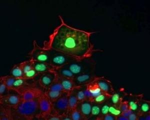 CICATRISATION des PLAIES: Même chez les cellules il y a des leaders et des followers – Nature Communications