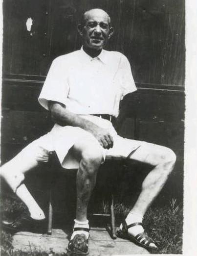 Frank Lentini, l'homme à trois jambes