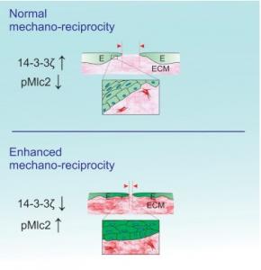 PLAIES CHRONIQUES: Découverte d'un puissant facteur empêcheur de cicatrisation – Developmental Cell