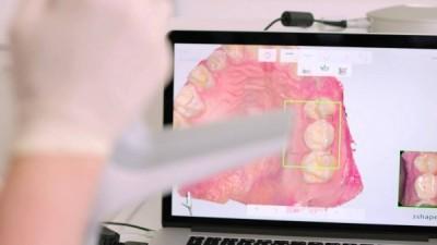 Fiabilité de lempreinte optique sur arcade complète :  prix de thèse UNECD 2015