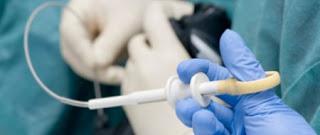 Vous reprendrez bien une petite fibroscopie ?