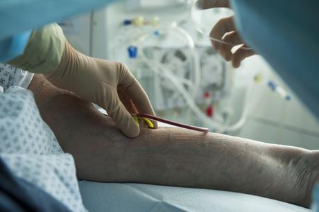 La douleur en dialyse: Et si tu te piquais??