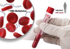 DIAGNOSTIC: Le test sanguin universel capable de détecter plusieurs types de cancer – Journal of Molecular Biology