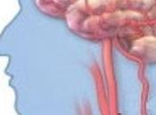 ALZHEIMER: L'effet neuroprotecteur certains antihypertenseurs Alzheimer's Research Therapy