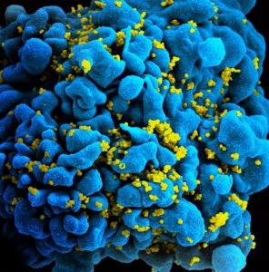VIH: Coincer le virus dans le tractus génital féminin – The Journal of Clinical Investigation