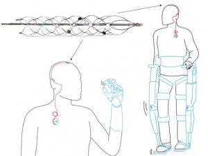 PARALYSIE: Stentrode ou l'idée d'une colonne vertébrale bionique – Nature Biotechnology