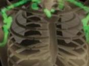 OBÉSITÉ: stress modéré active graisse brune favorise perte poids Experimental Physiology